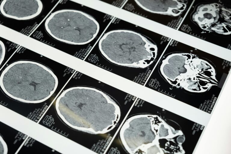 Climate Causes Severe Mental Problems