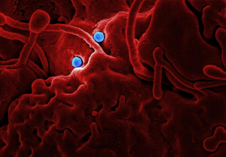 Flesh-Eating Bacteria Thrive On Global Warming